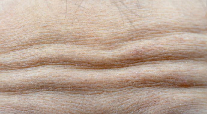 What Happens To Your Skin During Menopause?